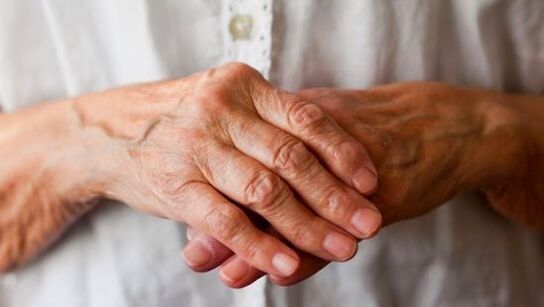 ревматоиден артритис како причина за болка во зглобовите на прстите