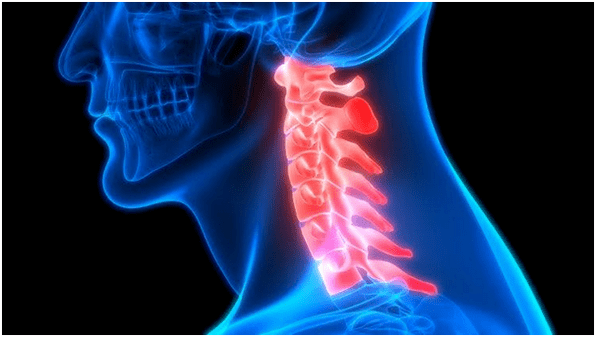 болката во вратот доведува до болки во грбот